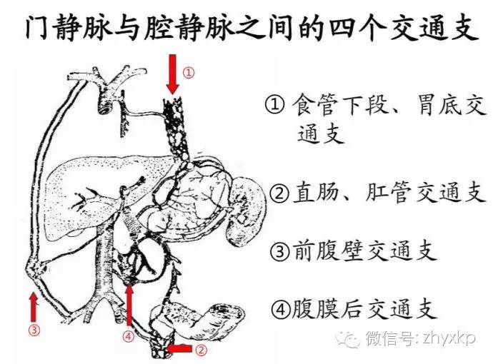 肝硬化上消化道反复出血咋办,肝硬化消化道出血能喝牛奶吗