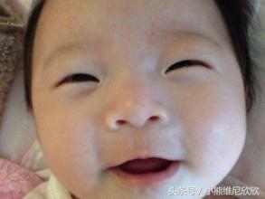 多层眼皮属于什么眼型,眼皮怎么分眼型