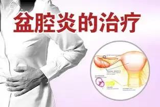 女人妇科病盆腔炎腹痛,盆腔炎腹股沟会痛吗