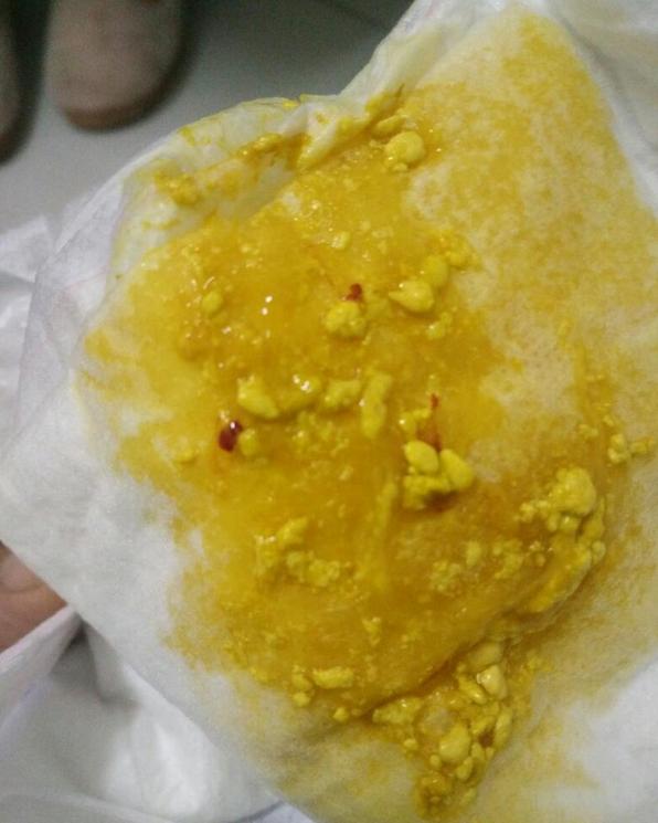 宝宝粑粑有红血丝还有果冻粘稠,宝宝拉冻冻的便便怎么回事