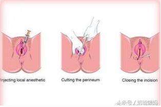 生孩子开几指了意味着什么？那些事你真的明白吗？