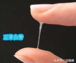 改善白带异常饮食有良方,从中医角度看白带异常