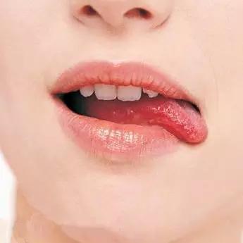 冬季孩子嘴唇红肿干裂老是舔,冬季嘴唇干裂破皮出血怎么办