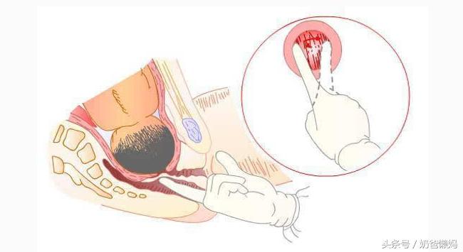 生孩子开几指了意味着什么？那些事你真的明白吗？