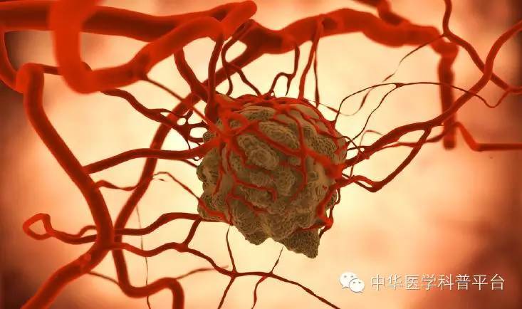 查出来肿瘤标志物高怎么办,检查出恶性肿瘤但肿瘤标志物正常