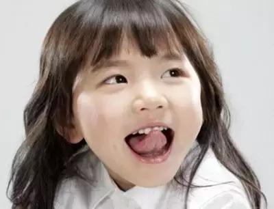 孩子割舌系带后说话不清楚怎么办,孩子说话不清楚要剪舌系带吗