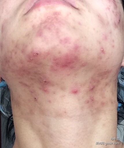 护肤一百问答,女孩健身护肤知识问答