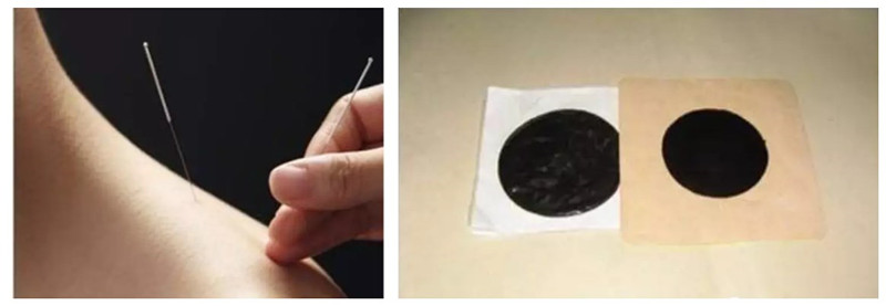 皮肤科科普：关于牛皮癣（白疕）你知道多少？