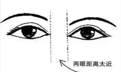 什么人适合开内眼角和外眼角,每个人都适合开外眼角吗