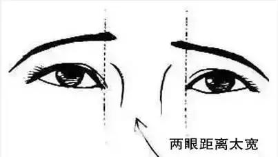 什么人适合开内眼角和外眼角,每个人都适合开外眼角吗