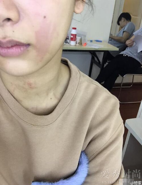 张歆艺抗疫情,张歆艺张芷溪