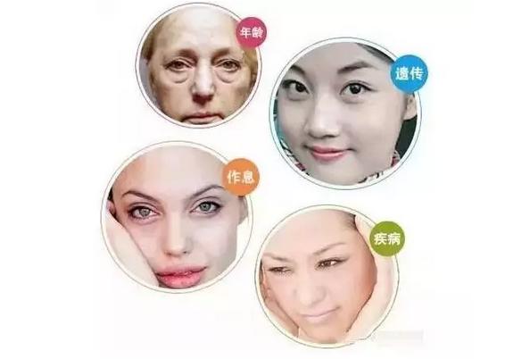 眼袋是什么原因引起的怎样消除,眼袋是怎么造成的有了眼袋怎么办