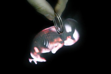 带环怀孕的宝宝能要吗,带环几年了怀孕的几率有多大