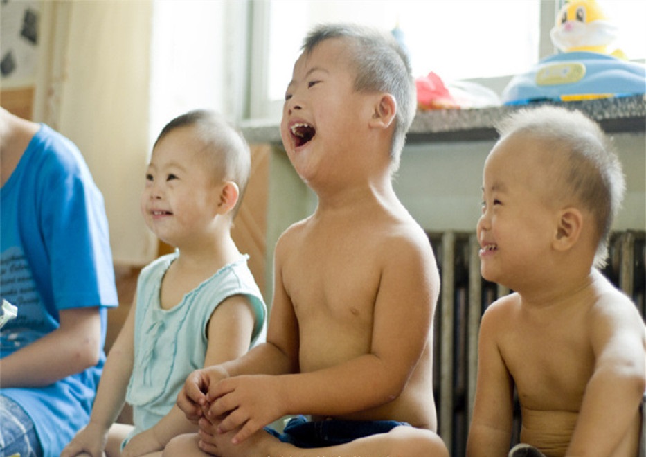 后期发现宝宝是唐氏综合征,唐氏综合征会长胖吗