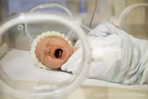 别等病到了再着急———新生儿特点及常见疾病预防