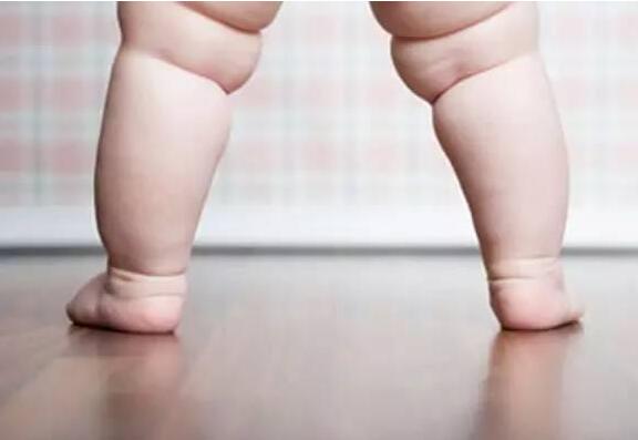 一岁半宝宝突然瘸了,1岁半小孩走路突然一只腿瘸