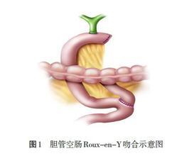 术后慢性腹痛怎么治疗,前交叉术后持续发烧疼痛