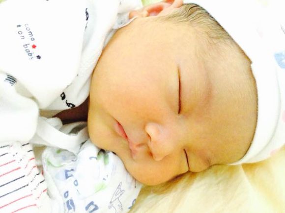 生理性黄疸对孩子有益吗,生理性黄疸值高会影响大脑吗