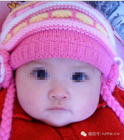 女幼童为啥会得外阴炎,女婴为什么会有外阴炎症