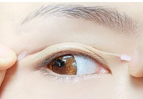 史上最全的双眼皮攻略，手把手教你如何形成双眼皮！