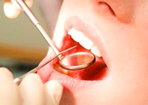 治疗牙周炎牙齿松动的偏方秘方,什么药偏方治疗牙周炎去除牙结石