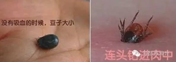 大妈被虫子咬,福建被虫咬案例