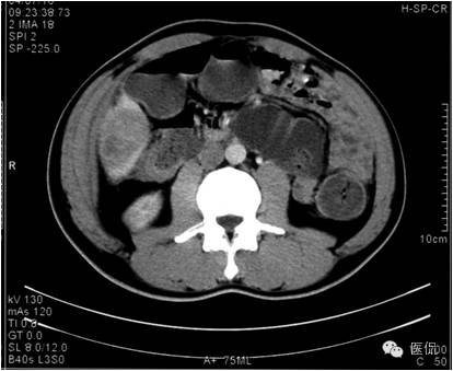 鐥呯悊鍒囩墖闃呯墖澶ц禌,鐥呯悊闃呯墖姣旇禌
