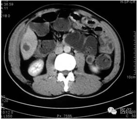 鐥呯悊鍒囩墖闃呯墖澶ц禌,鐥呯悊闃呯墖姣旇禌