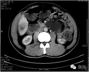 鐥呯悊鍒囩墖闃呯墖澶ц禌,鐥呯悊闃呯墖姣旇禌