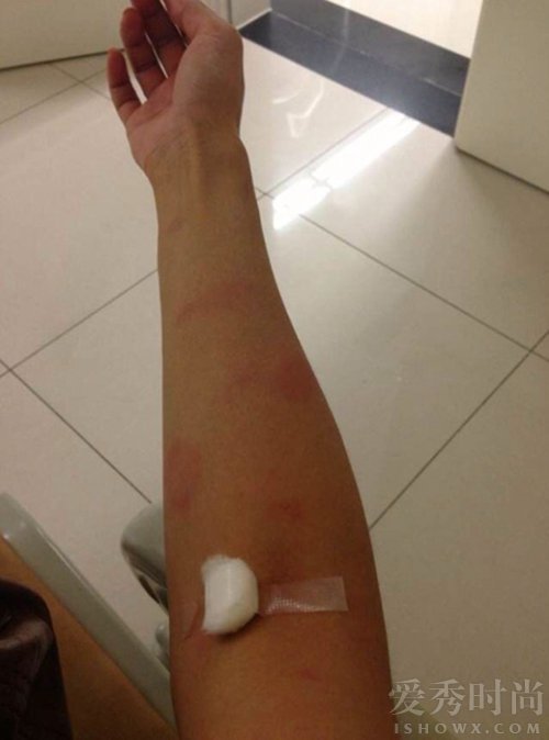 张歆艺抗疫情,张歆艺张芷溪