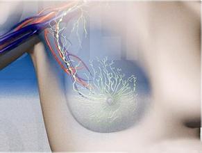 乳腺癌新辅助化疗完全缓解 (乳腺癌的辅助化疗方案及对策)