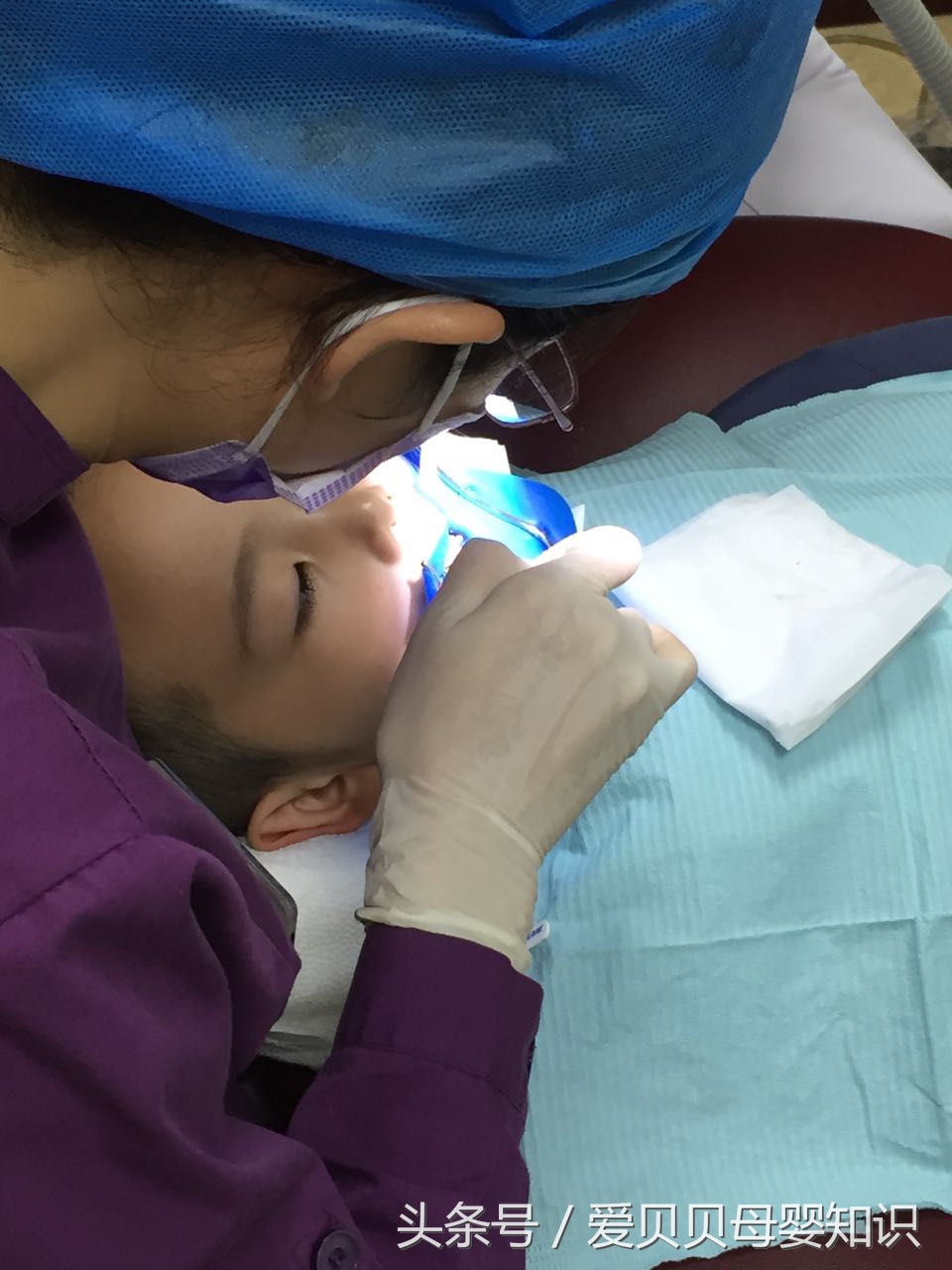 带娃两地看牙记--北京儿童医院，私立医院，及全麻补牙分享