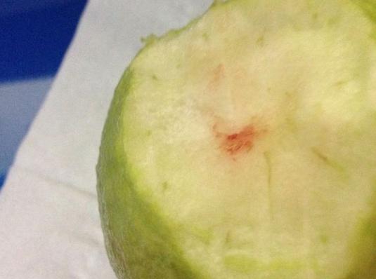 了解预防常识,健康科学有效的常见疾病预防方法