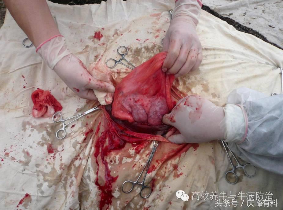 奶牛真胃扩张的症状治疗方法,奶牛皱胃左方变位治疗方法