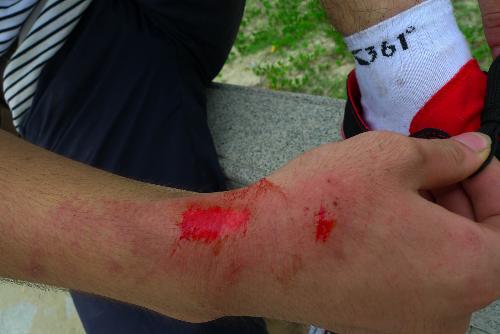 10种家庭常备药清单,家中常备的伤湿止痛膏的20种用法