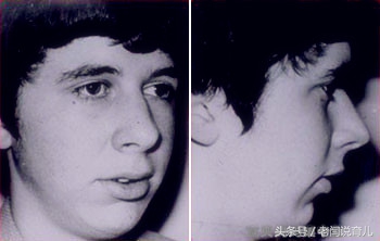 为什么我家孩子下巴短,孩子下巴短改善案例