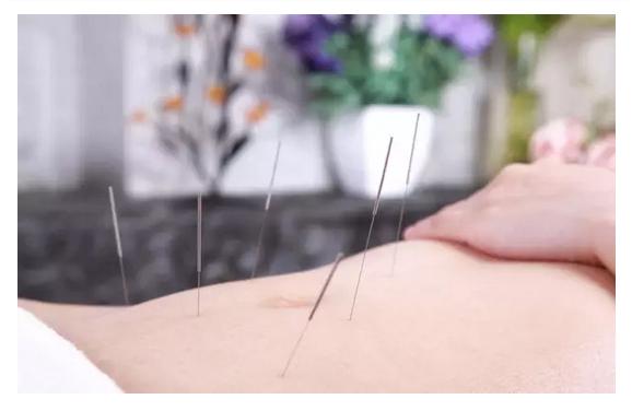 每个胖子都应该看：针灸治疗肥胖症