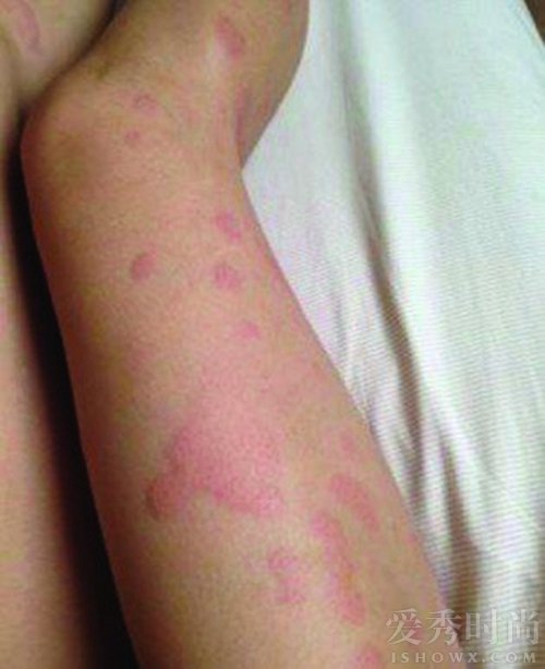 张歆艺抗疫情,张歆艺张芷溪