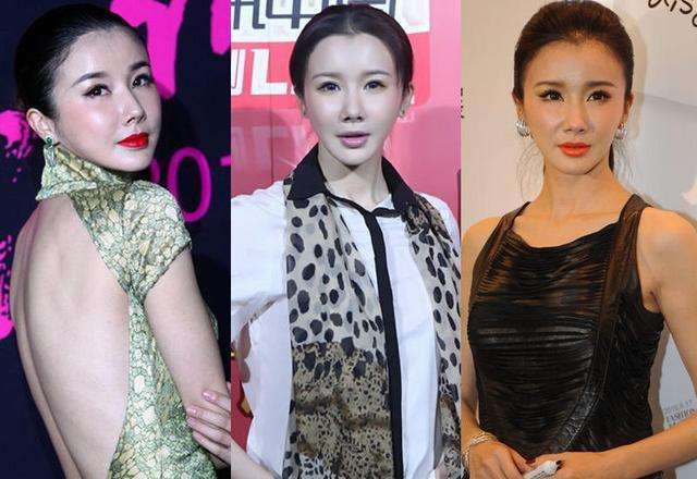 女明星整容后后遗症,女明星整容后出现后遗症