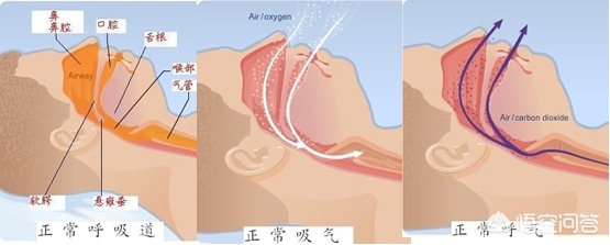 睡觉打呼噜最好的治疗方法,为什么只有睡觉时才打呼噜