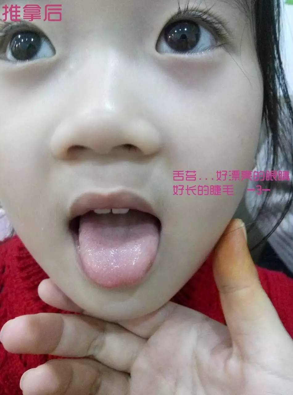 中医如何调理过敏性体质,过敏性体质的孩子怎么调理