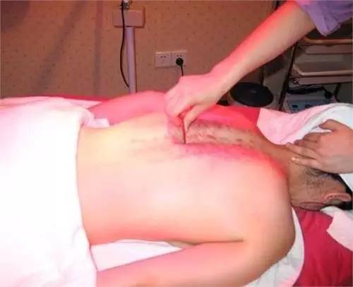 年轻人肩周炎是什么原因引起的,肩周炎是冬季高发期吗