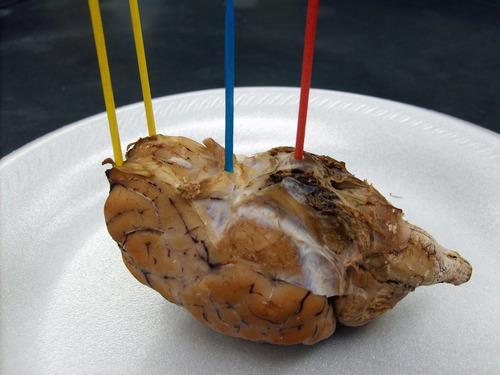 最佳治疗宿醉,看医生如何治理醉鬼