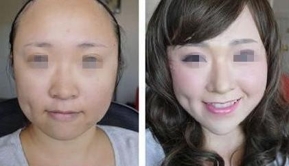 痱子粉也能隆鼻啊？看完给跪了