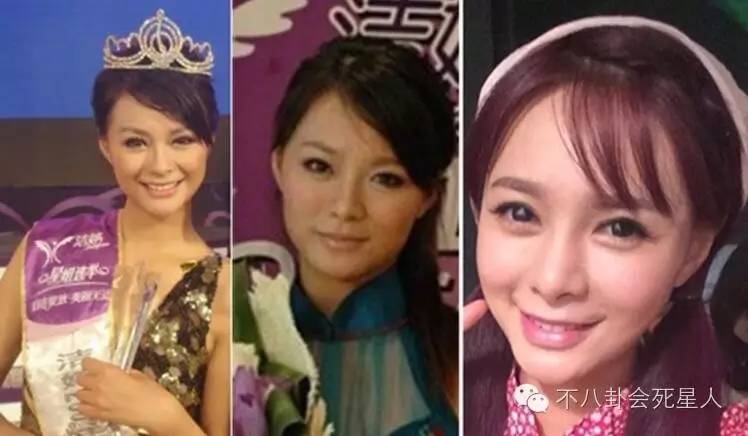 沈梦辰整下巴,沈梦辰有没有整下颚角