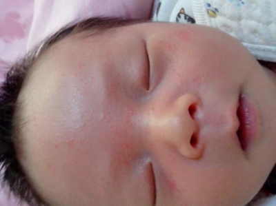 新生儿常见问题及处理文献,新生儿出生常见问题