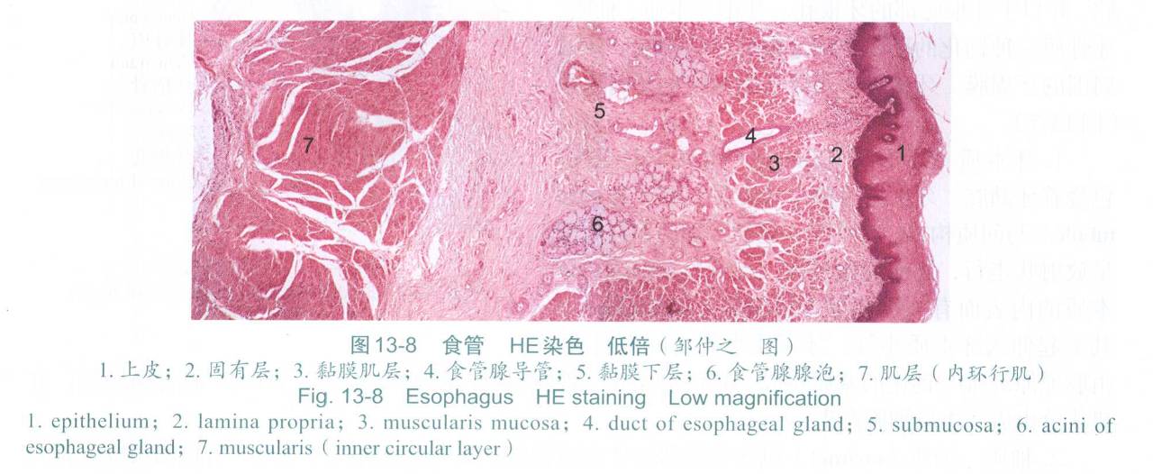 早期贲门癌内镜特征,内镜早癌