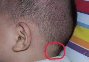 宝宝会动是不是所有器官都成熟了,婴儿淋巴结肿大会动