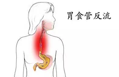 口臭腥臭味有痰什么原因,有口臭还经常咳出黄色小米粒