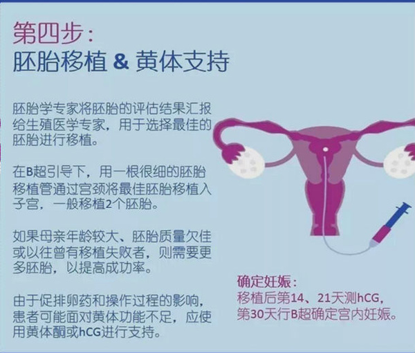 试管婴儿的正确方法及其流程,试管婴儿五种方法